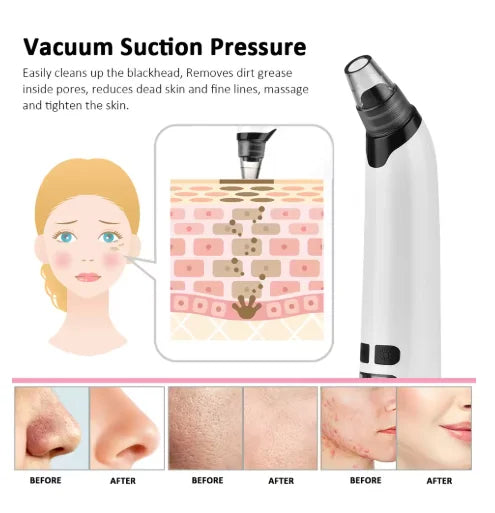 Blackhead Remover Vacuum Suction USB Rechargeable Facial Pore Cleaner Spot Acne Pimple Black Head Deep Extractor Skin Care Kit