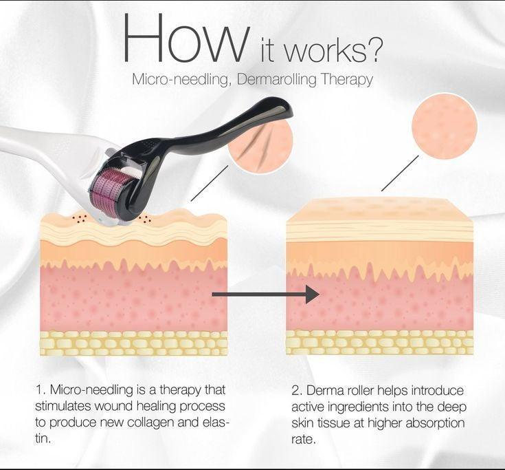 Derma Roller Dynamic Life 0.5mm - 540 Microneedle System for Hair Growth & Skin Therapy