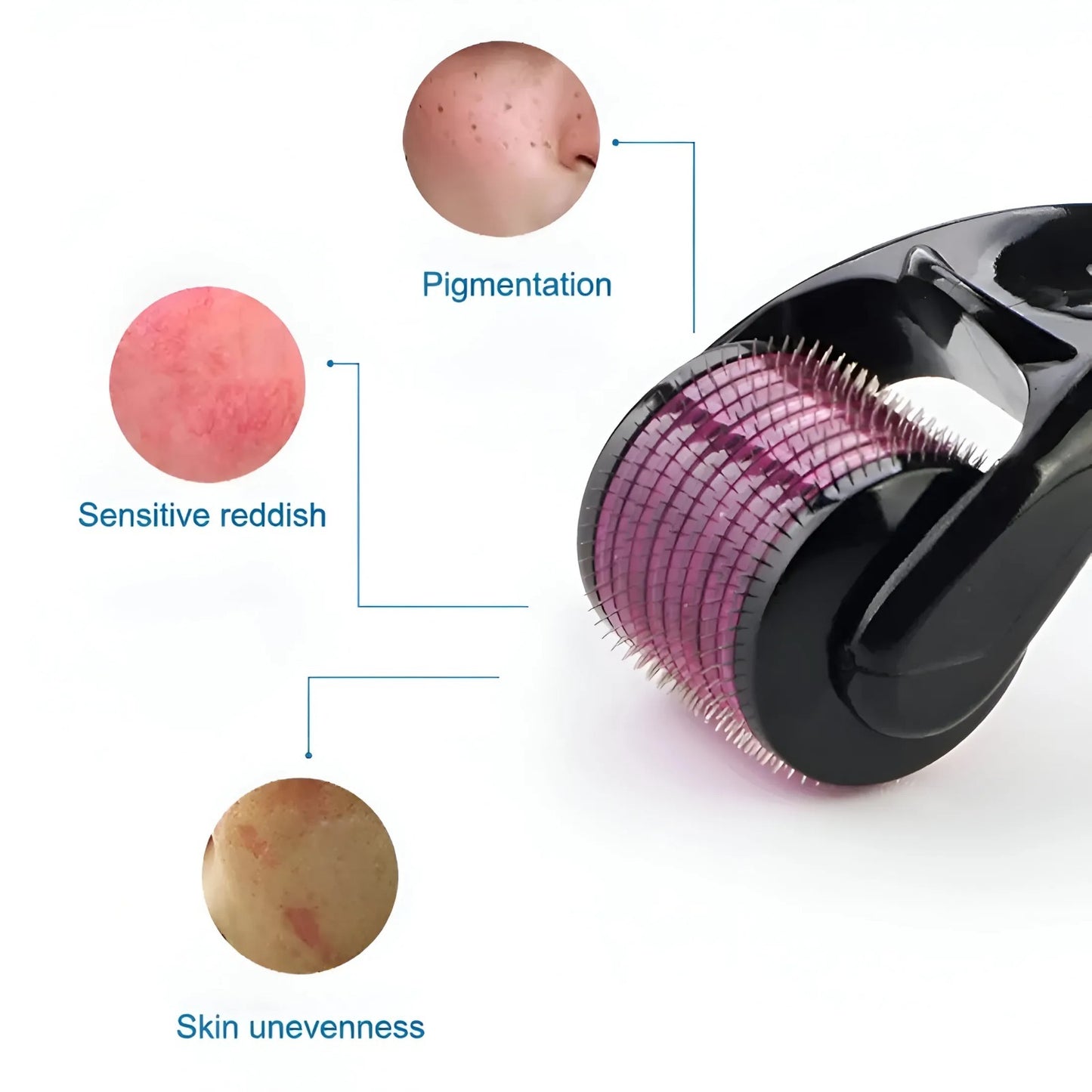 Derma Roller Dynamic Life 0.5mm - 540 Microneedle System for Hair Growth & Skin Therapy